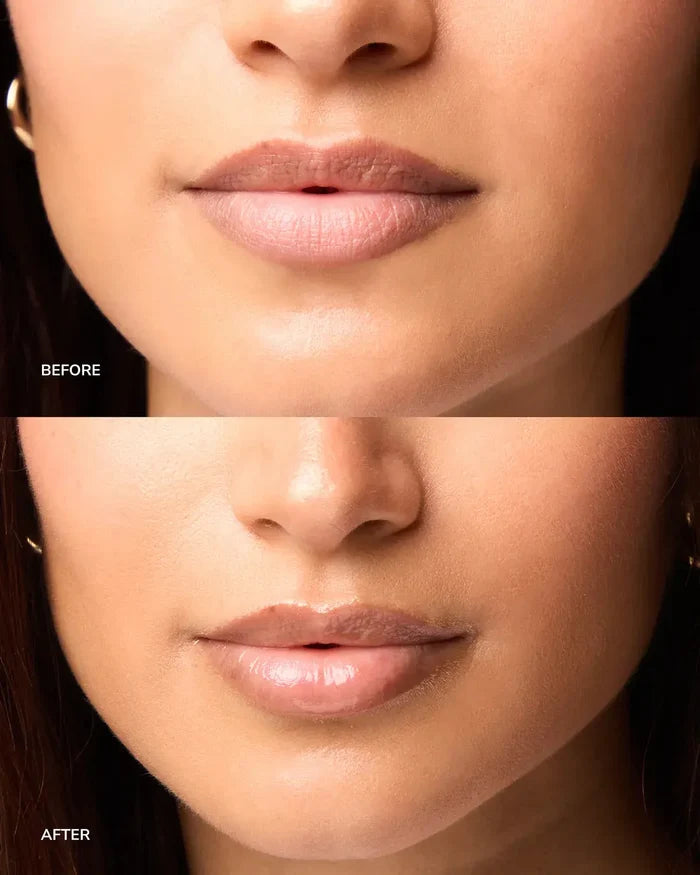 NORDH Lip Treatment - The Intensive Repair NORDH